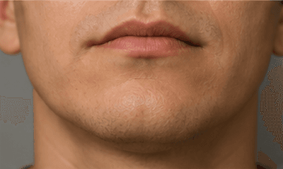 The bottom of a face — the chin below the mouth