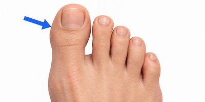 A foot with an arrow pointing to the big toe