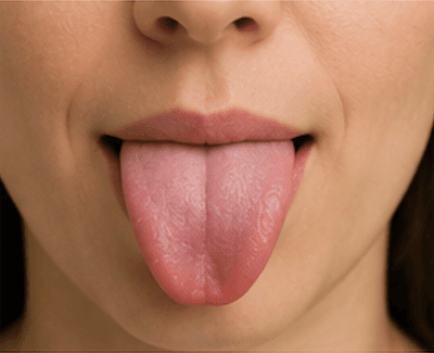 An open mouth showing the tongue